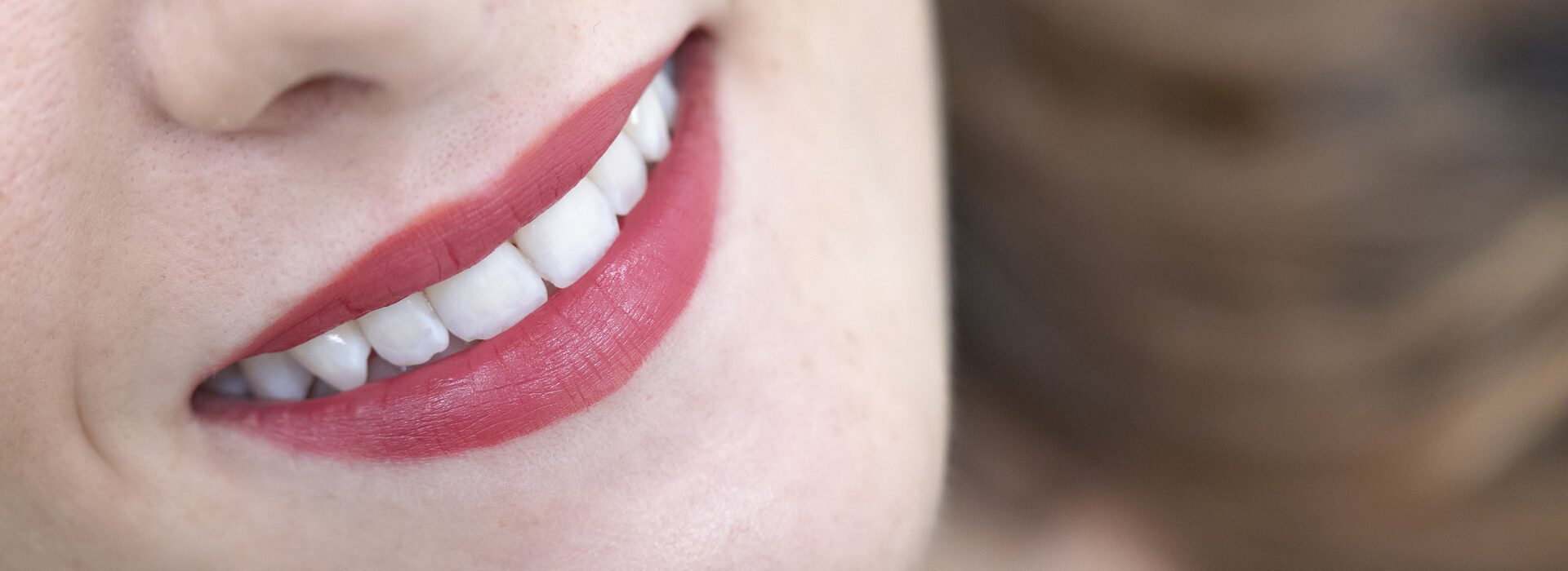 sbiancamento-denti-quarta-odontoiatria-studio-dentistico-carmiano-lecce_15