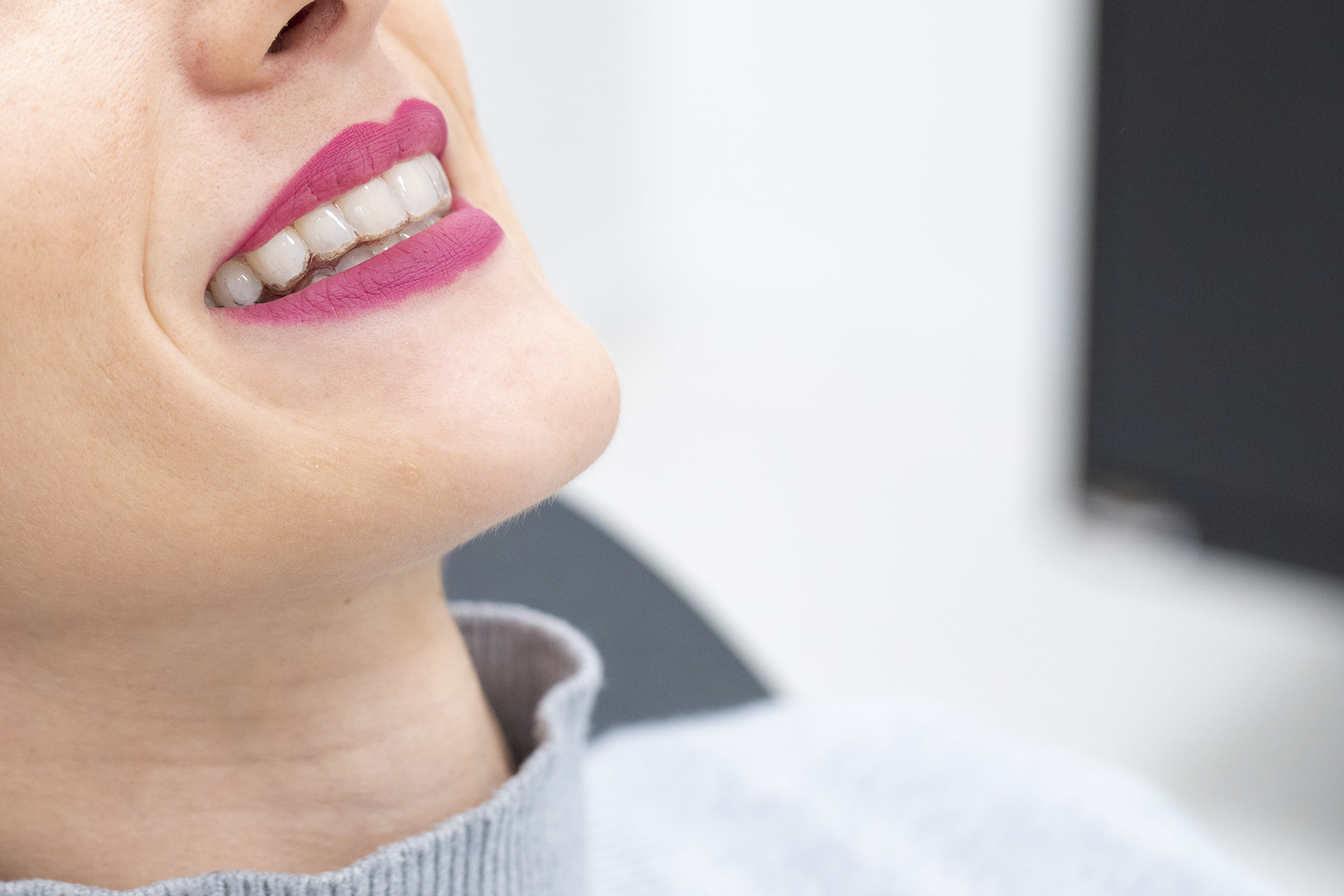 295A1965invisalign-quarta-odontoiatria-studio-dentistico-carmiano-lecce