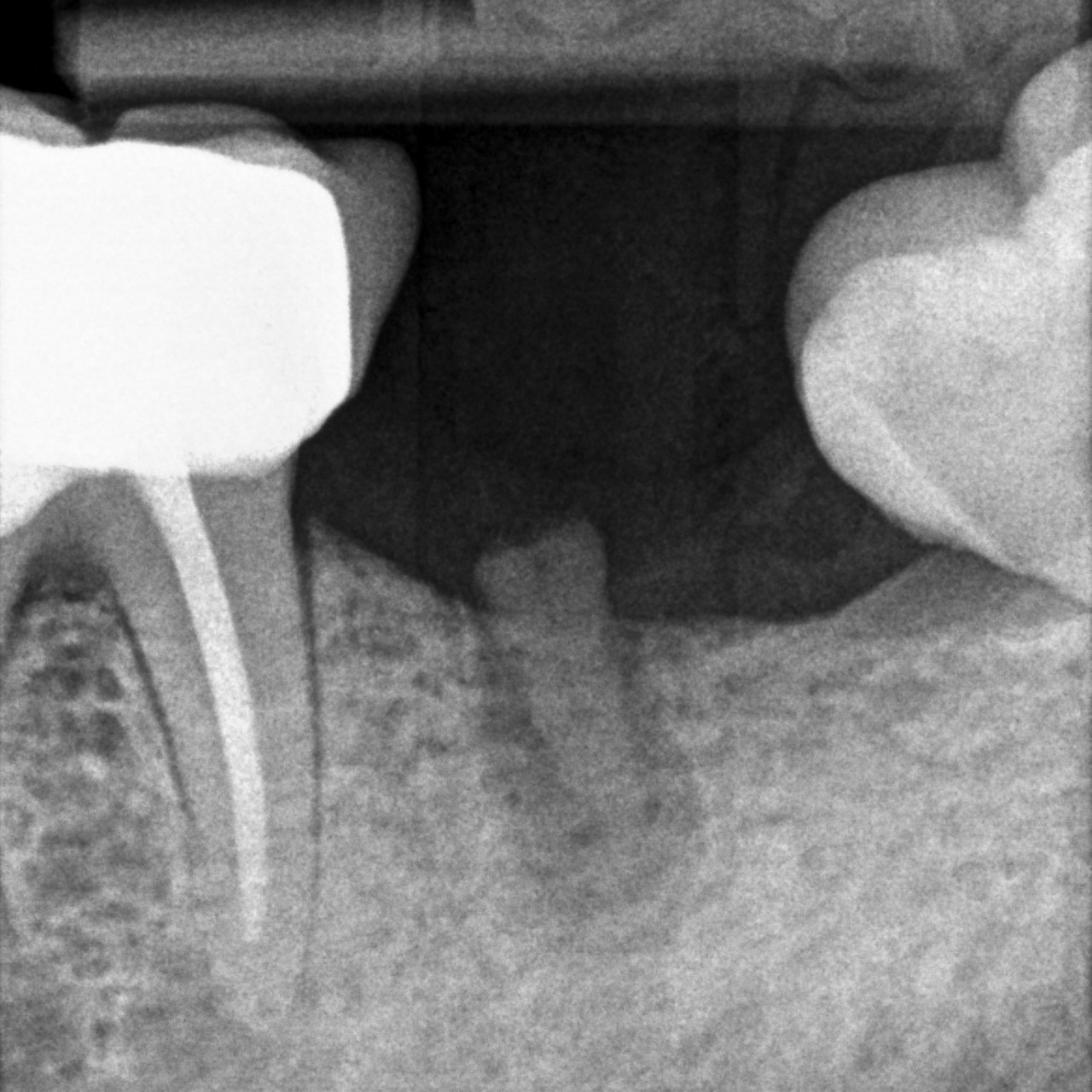 Attanasio_Alessandro_20220223_110106quarta-odontoiatria-studio-dentistico-carmiano-odontoiatria-digitale