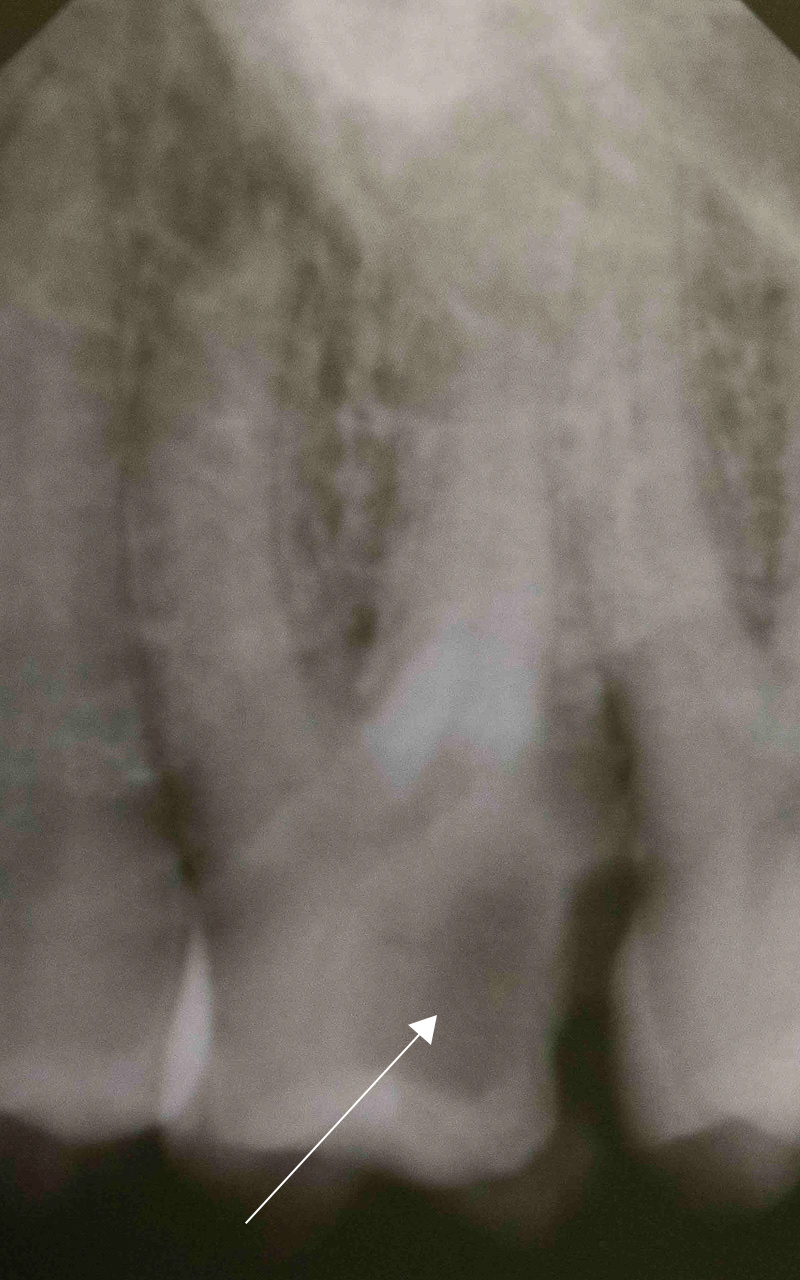 DSC_0104_1-fquarta-odontoiatria-studio-dentistico-carmiano-odontoiatria-digitale_1-1