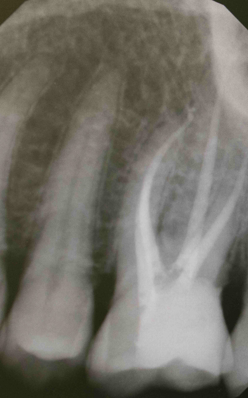 DSC_0104_1quarta-odontoiatria-studio-dentistico-carmiano-odontoiatria-digitale_2