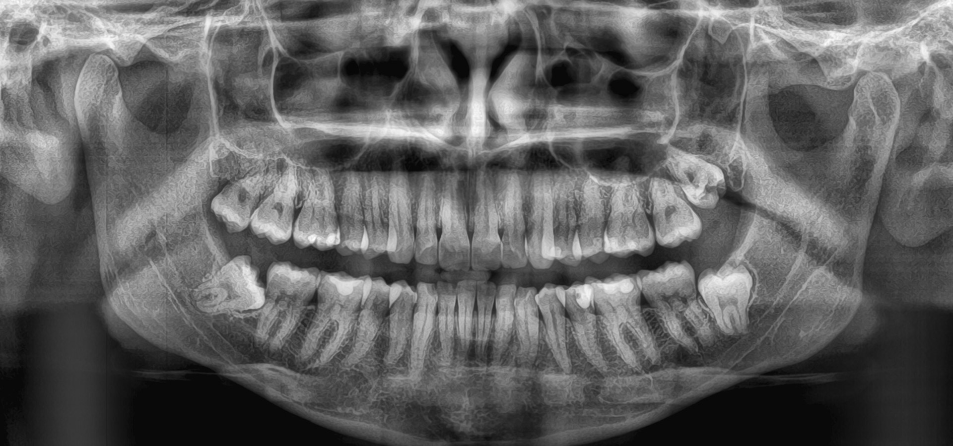 Baldassarre_Claudia_20221006_185252implantologia-quarta-odontoiatria-studio-dentistico-carmiano-lecce