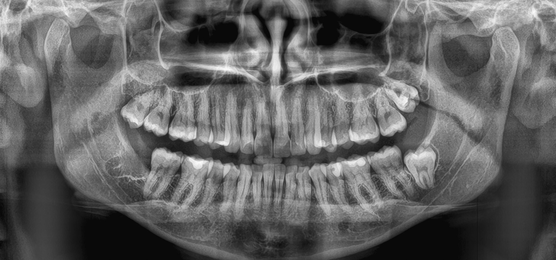 Baldassarre_Claudia_20221125_170552implantologia-quarta-odontoiatria-studio-dentistico-carmiano-lecce