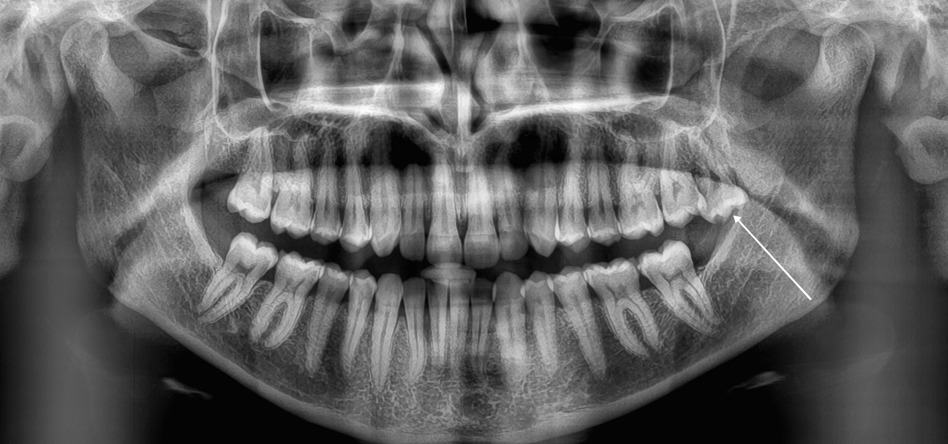 Centonze_Giulia_1_20210423_180803implantologia-quarta-odontoiatria-studio-dentistico-carmiano-lecce-1