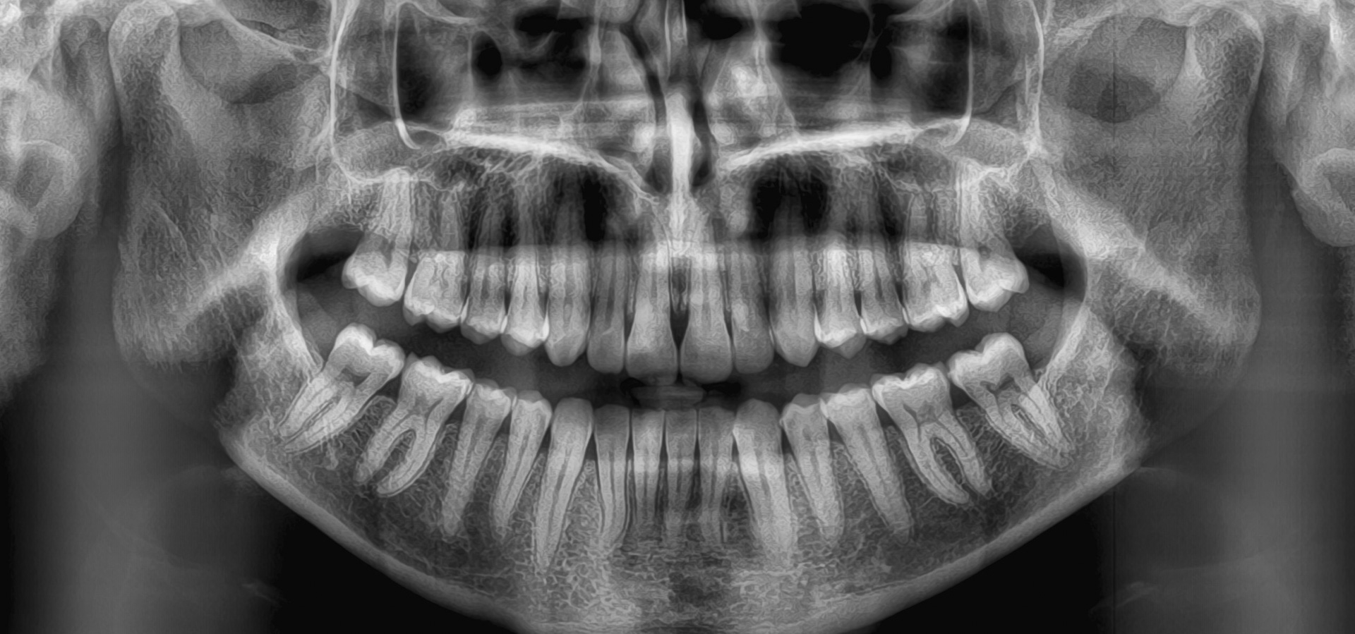 Centonze_Giulia_20221130_163013implantologia-quarta-odontoiatria-studio-dentistico-carmiano-lecce