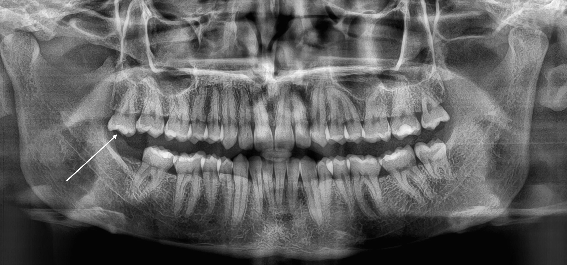 Centonze_Luisa_1_20210423_180803implantologia-quarta-odontoiatria-studio-dentistico-carmiano-lecce-1