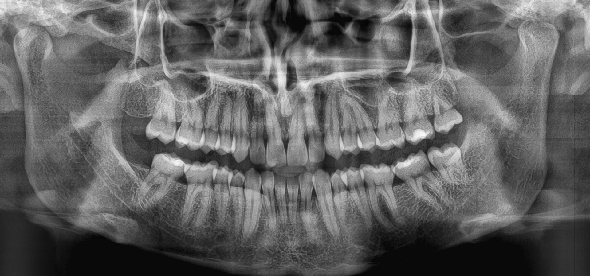 Centonze_Luisa_20221123_163025implantologia-quarta-odontoiatria-studio-dentistico-carmiano-lecce