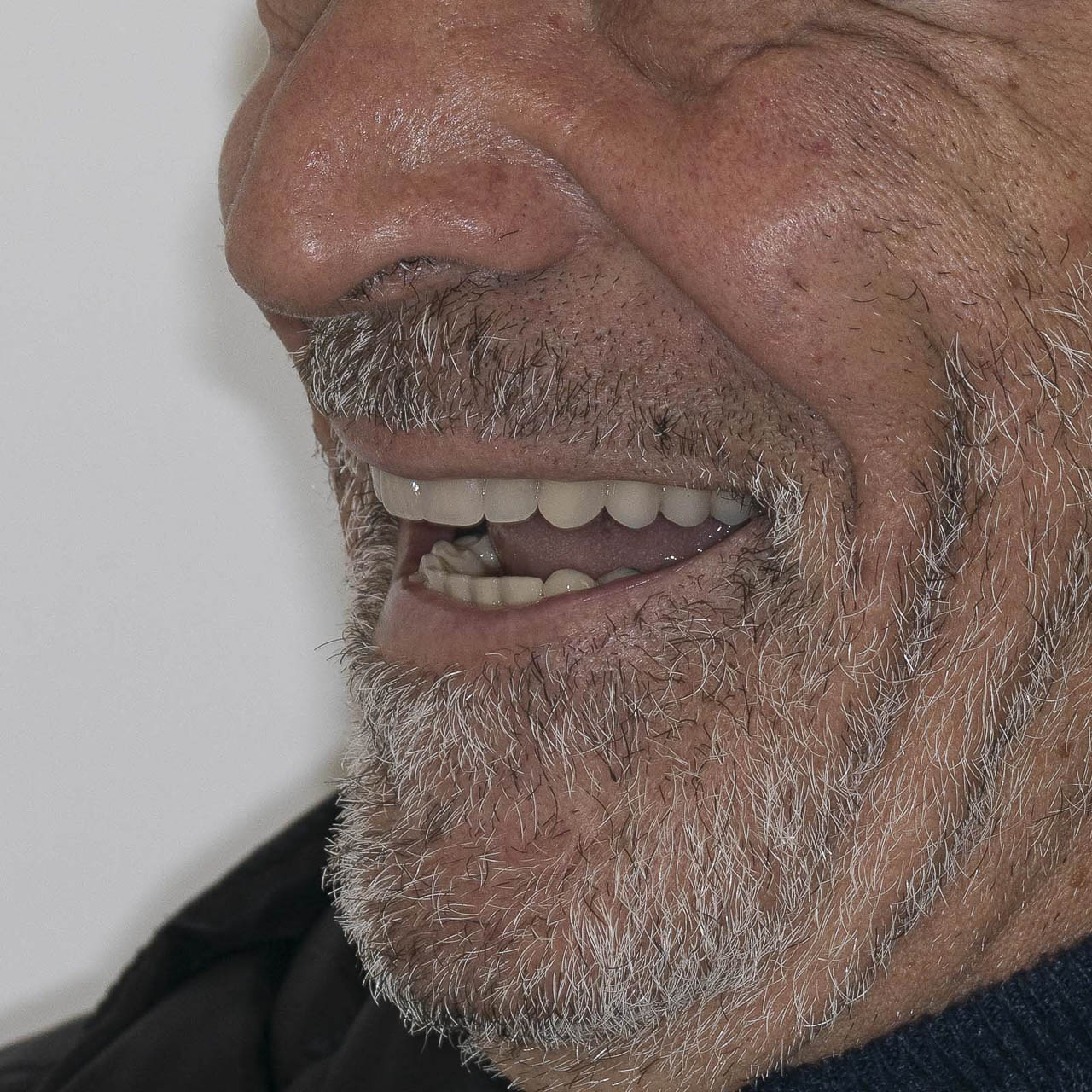 DSC_0715chirurgia-orale-implantologia-2-quarta-odontoiatria-studio-dentisticoimplantologia-quarta-odontoiatria-studio-dentistico-carmiano-lecce
