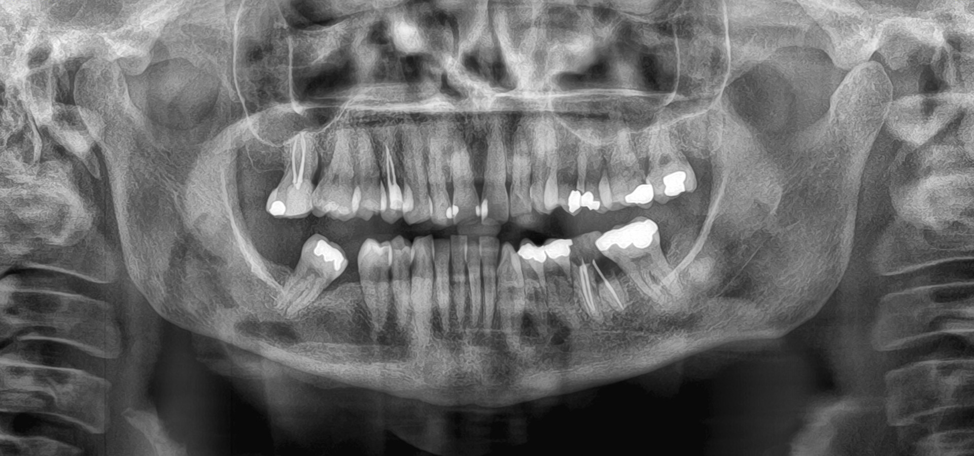De_Lorenzi_Maria_Grazia_20211220_192033implantologia-quarta-odontoiatria-studio-dentistico-carmiano-lecce