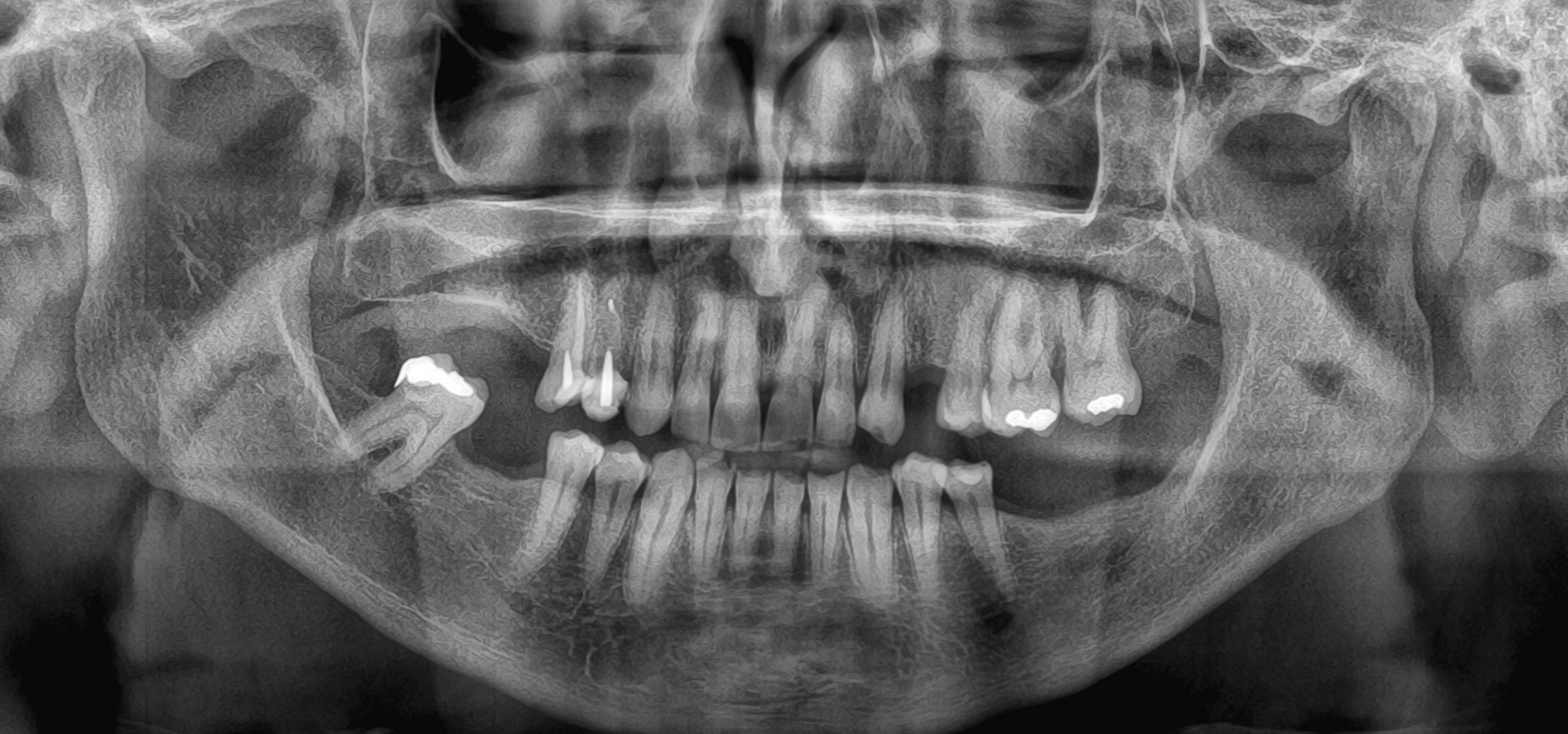 Quarta_Maria_Rita_20220326_103228implantologia-quarta-odontoiatria-studio-dentistico-carmiano-lecce