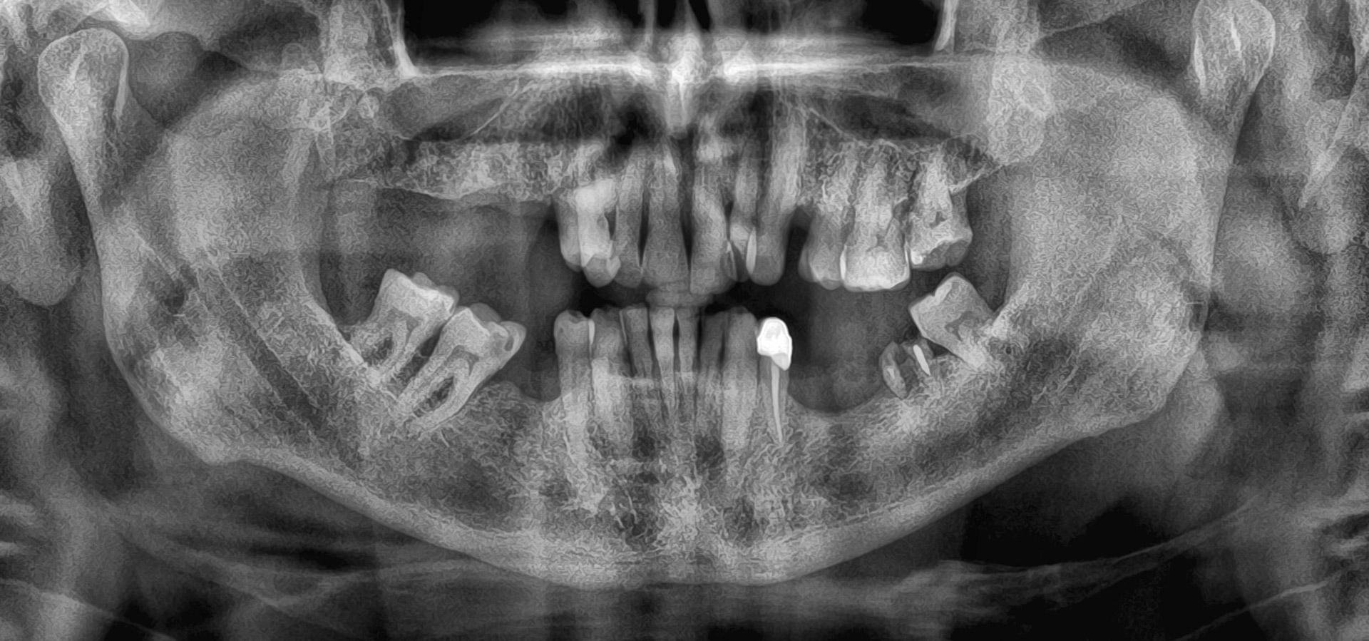 Quarta_Mario_20220706_202145implantologia-quarta-odontoiatria-studio-dentistico-carmiano-lecce