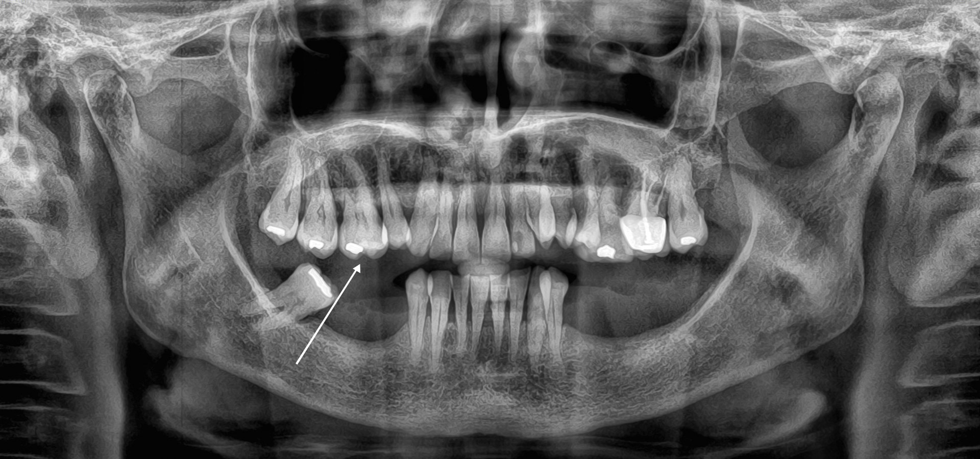 Solinas_1_20210423_180803implantologia-quarta-odontoiatria-studio-dentistico-carmiano-lecce-1