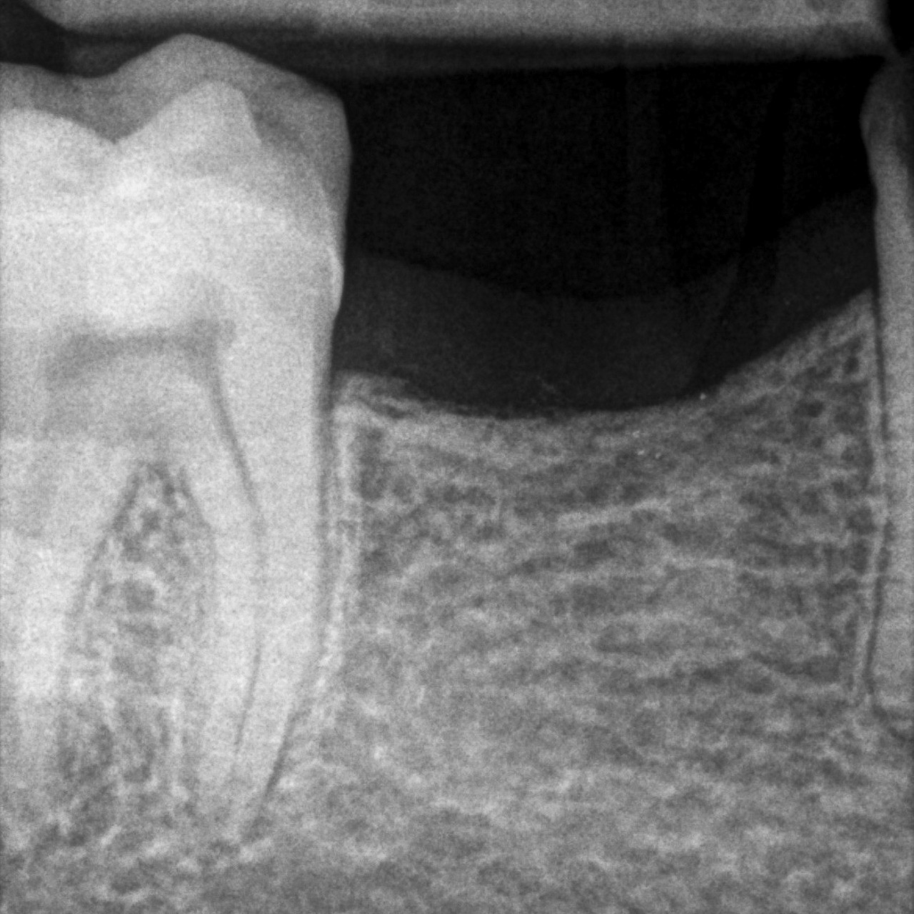 Sozzo_Ilaria_20210721_175252quarta-odontoiatria-studio-dentistico-carmiano-odontoiatria-digitaleimplantologia-quarta-odontoiatria-studio-dentistico-carmiano-lecce