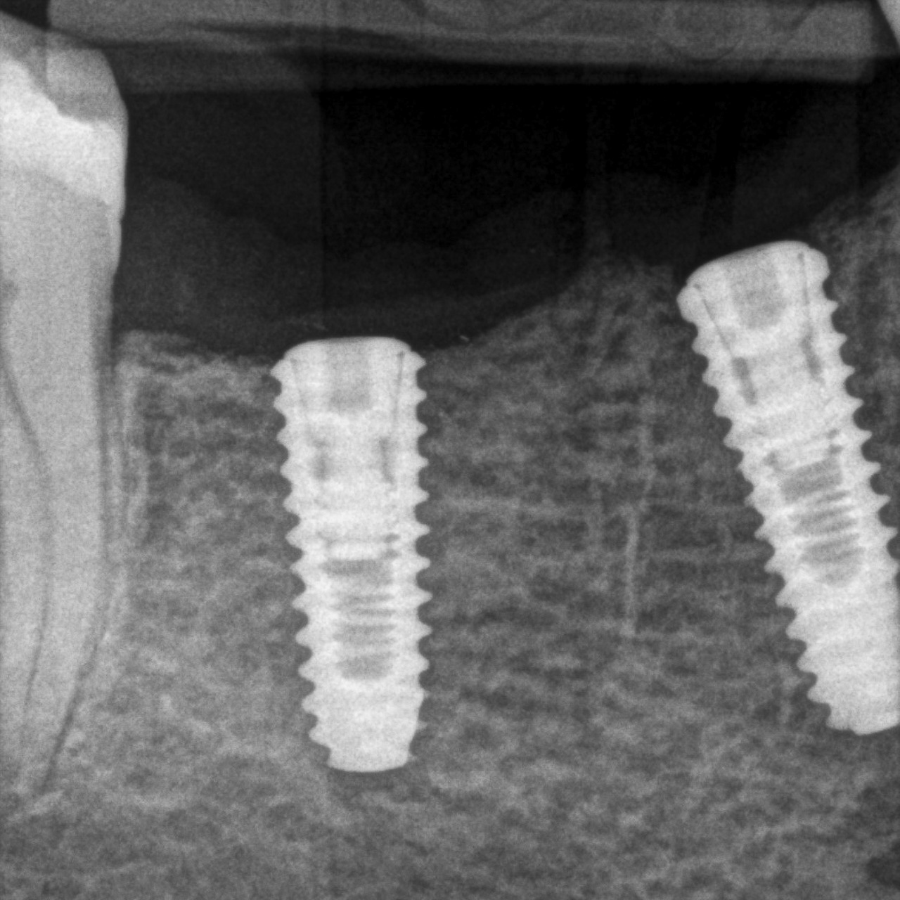 Sozzo_Ilaria_20220912_144050quarta-odontoiatria-studio-dentistico-carmiano-odontoiatria-digitaleimplantologia-quarta-odontoiatria-studio-dentistico-carmiano-lecce